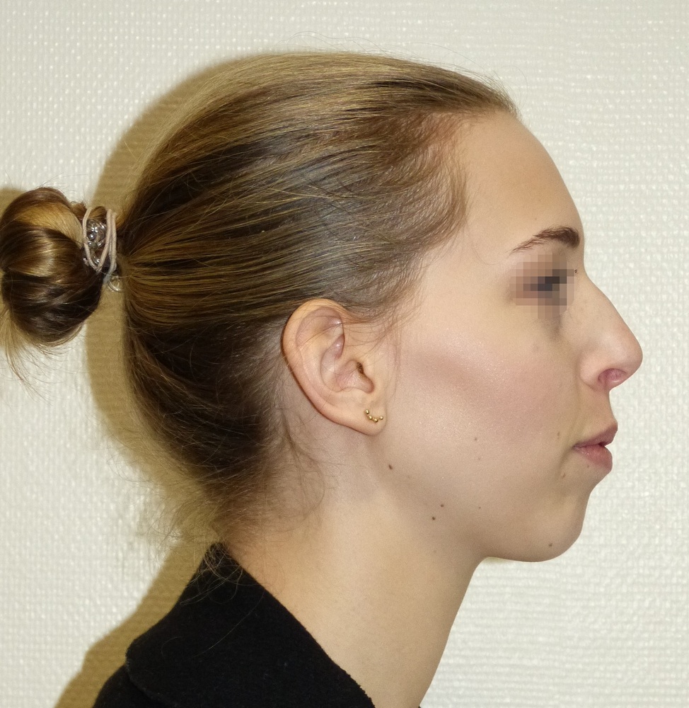 A773251C 542E 40C0 B983 DE8C52A9776D