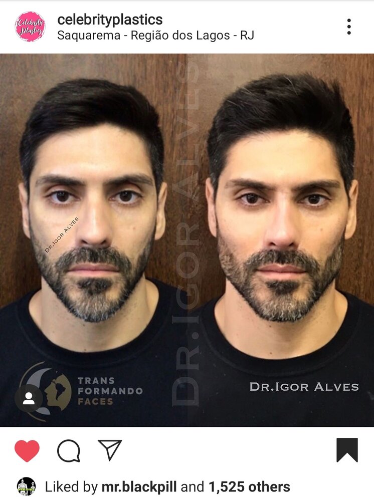 Screenshot 20200903 131722 Instagram