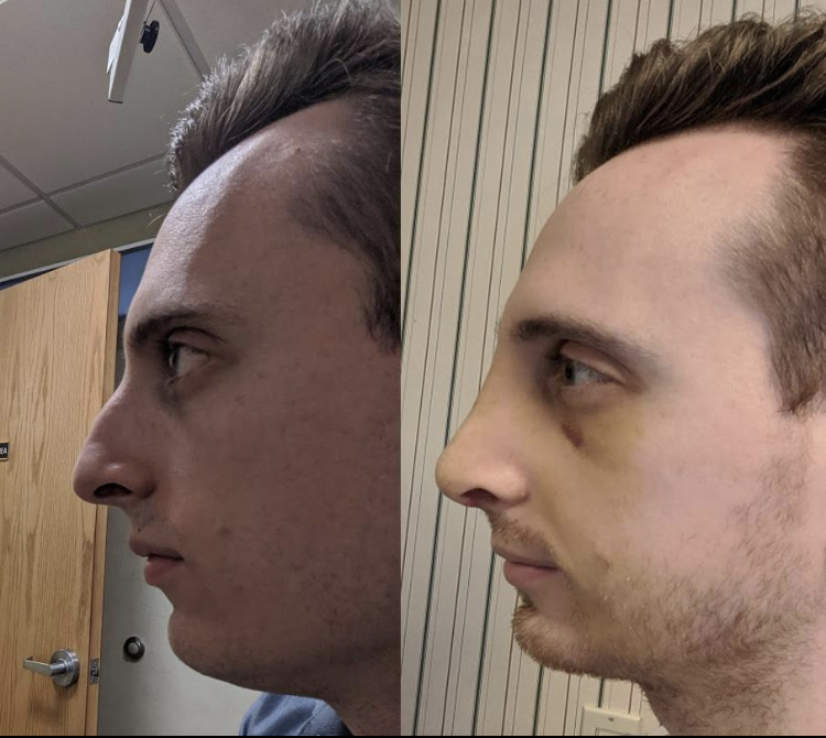 0F16CA65 E508 4993 BE60 526ABF8B4B1C