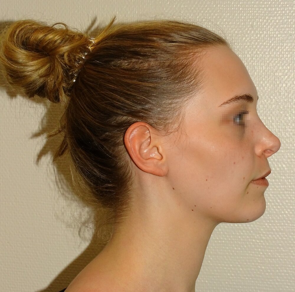 5ADA7423 4331 42D5 A352 58F3B310EE0F