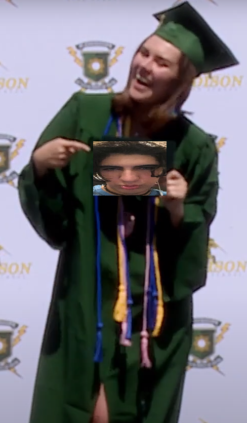SUAB
