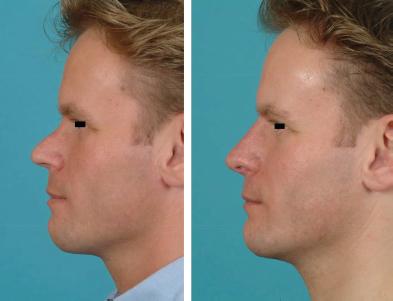 10 1055 b 004 140249 c021 f004