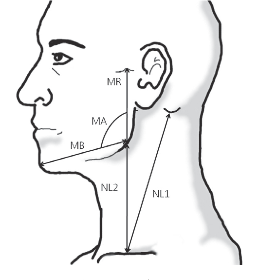 2 Figure1 1