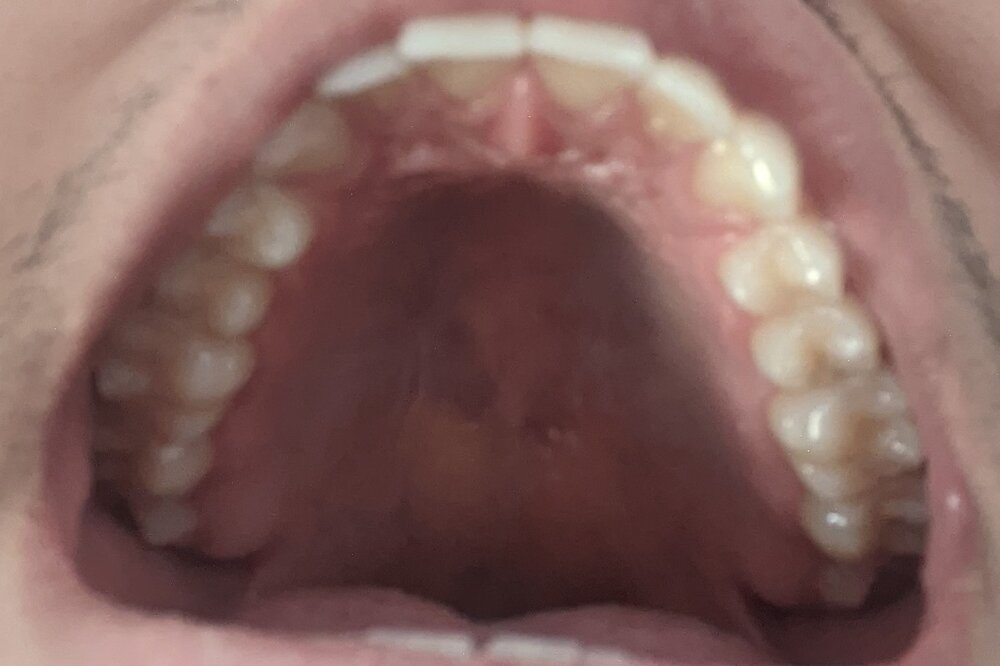 PXL 20200908 205444865MP