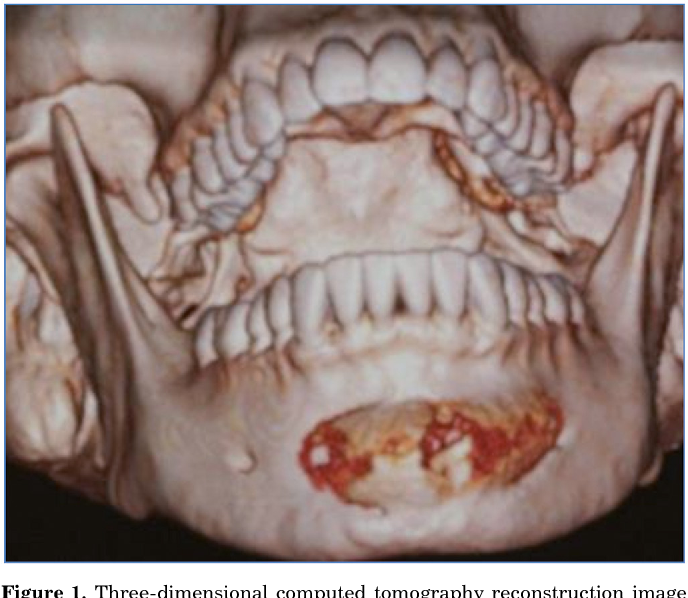 1AA3C7BF 9D2D 49FB 8CB5 53889B40DB65