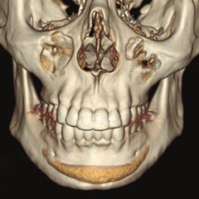 1E8E8C3A B09E 4B2F B6A7 6E3D6C828C58