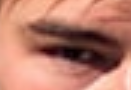 Under eye support seid xd