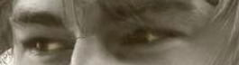 Positive under eye support 2