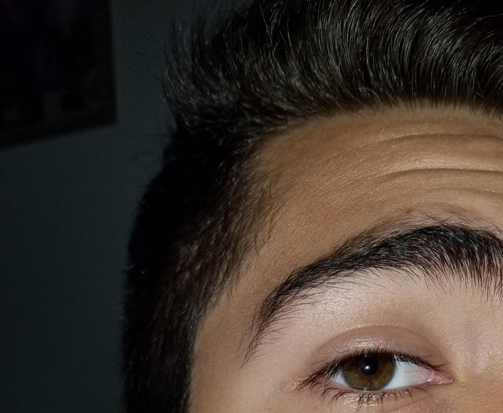 Eye