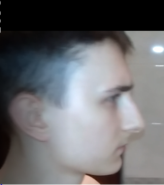 Xdd