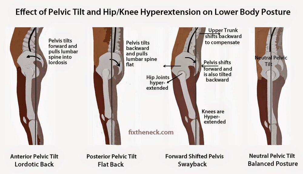 Hip posture
