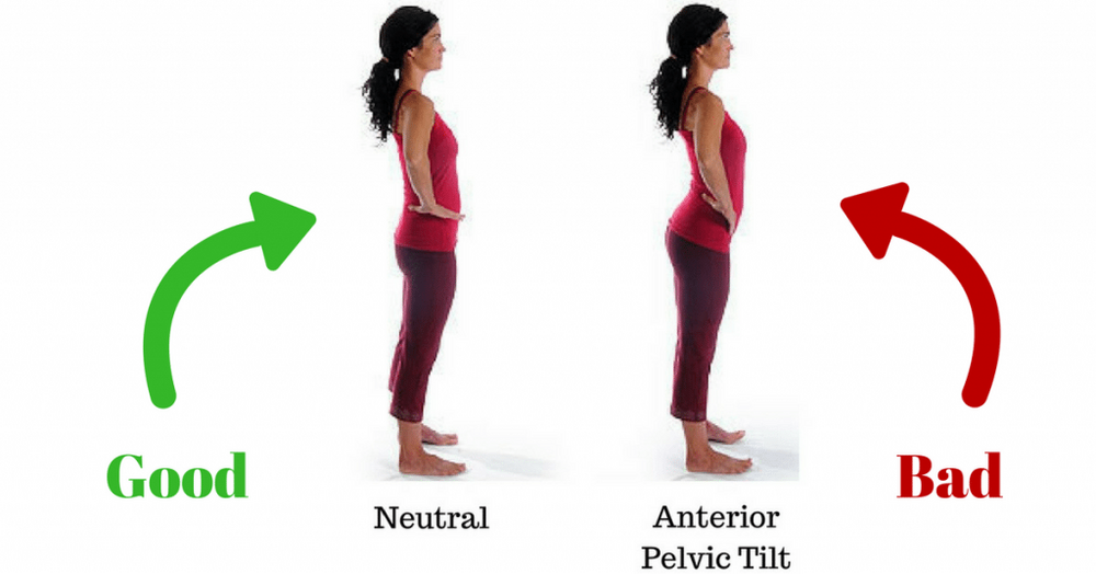 Anterior pelvic tilt 1024x536