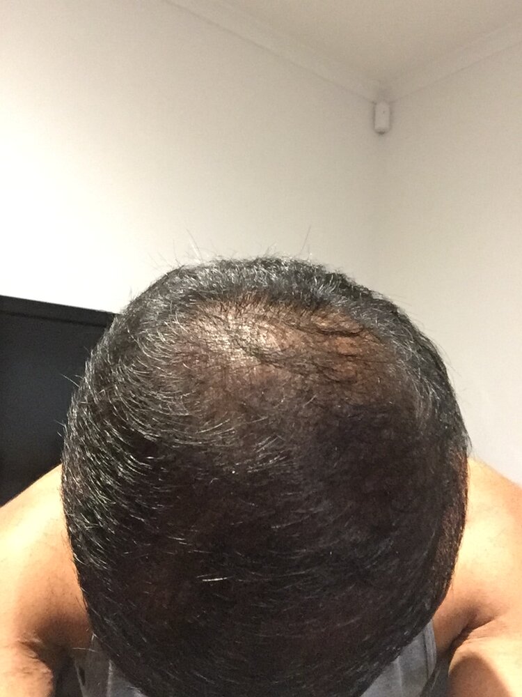 7F51BF61 7FEF 4A70 923C 03C78D91FB8D