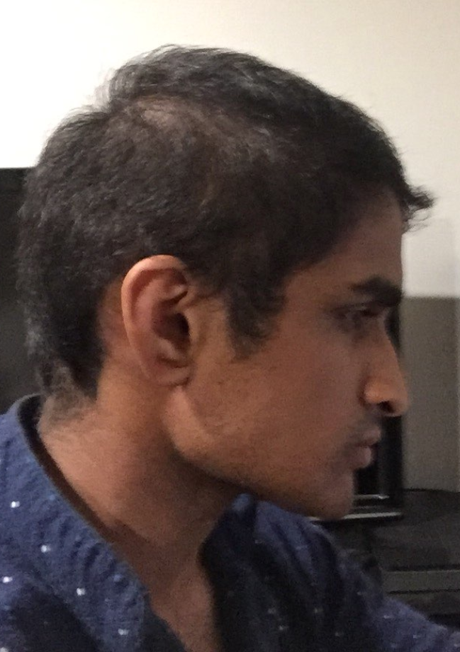 1600174416631