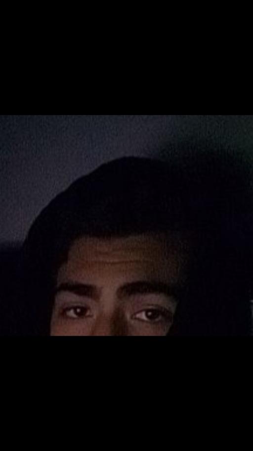 Eye