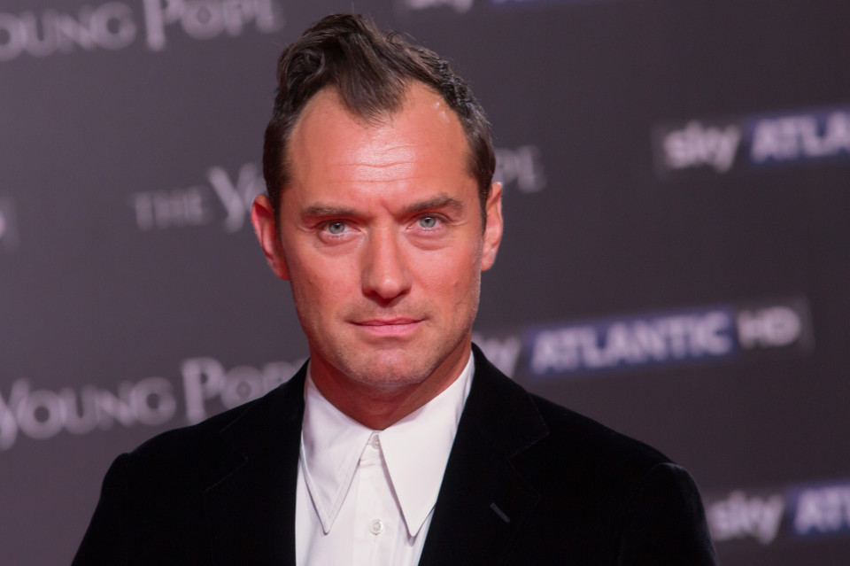 Balding celebrities hair loss