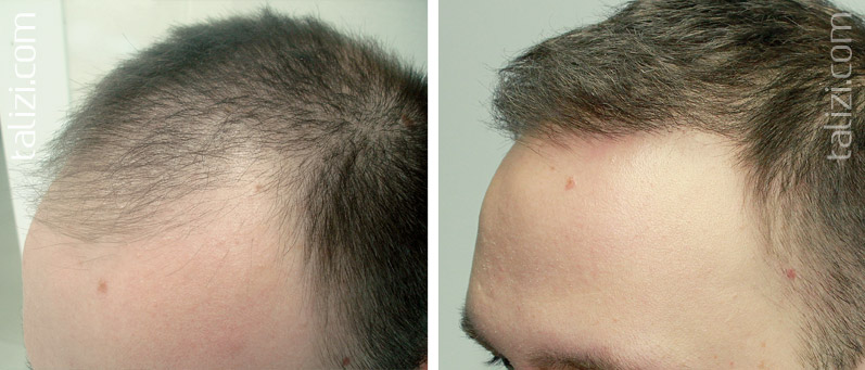 Patient17 pic2