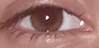 Eye