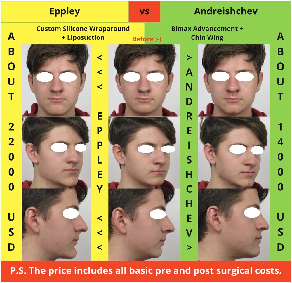 Eppley vs Andreishchev
