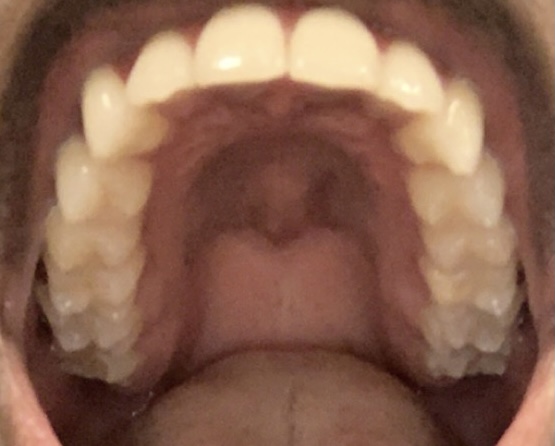 F47E44E6 C637 44D3 8CDA AD4A50EDE4A2