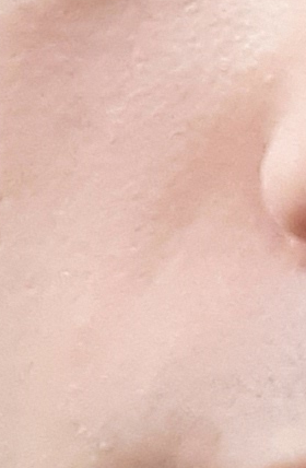 Sl