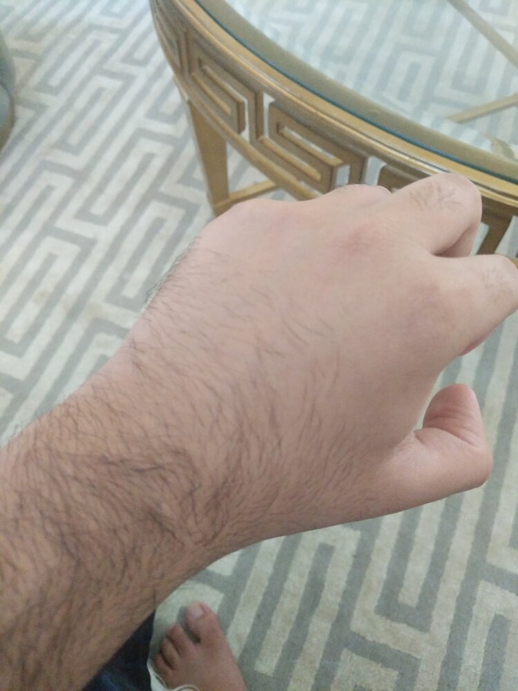 1600632046820970445656764654101