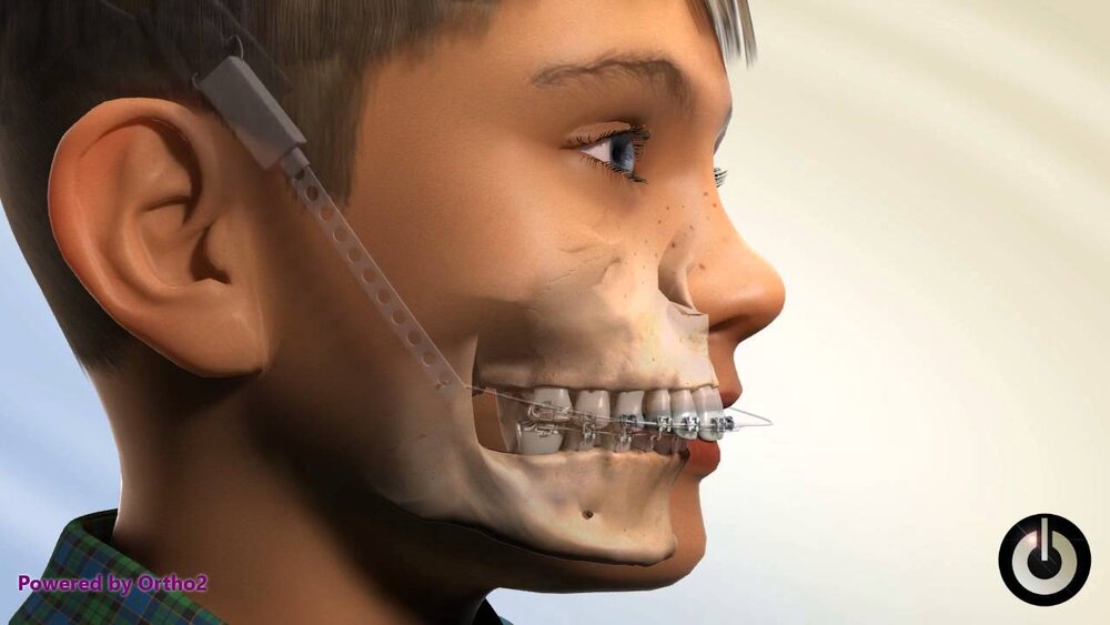 Image from https://i.ytimg.com/vi/ZYWheBWGxTs/maxresdefault.jpg