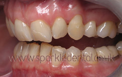 Ortho4