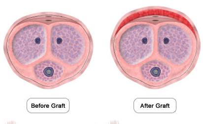 Bigger penis stem cells