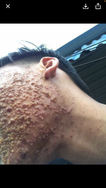 Iasasamage0