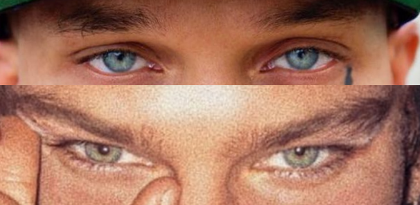 Eye