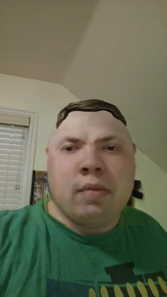 Tinyhairlossus