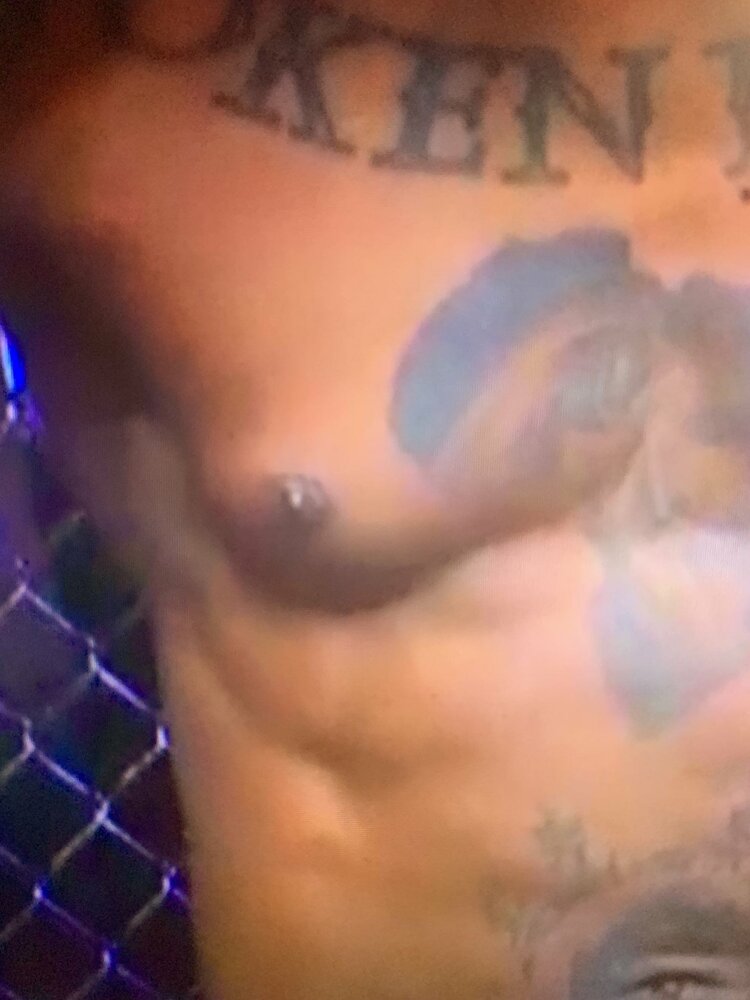 Gyno
