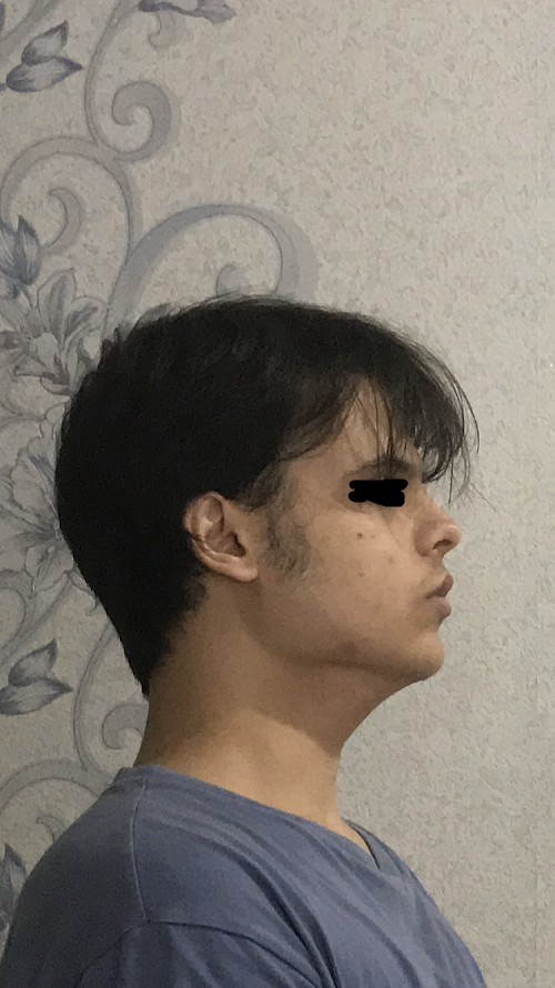 IMG 0417