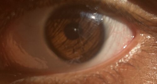 eye.jpeg
