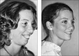 Jawsurgery