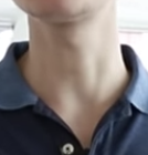 firesa neck before.png