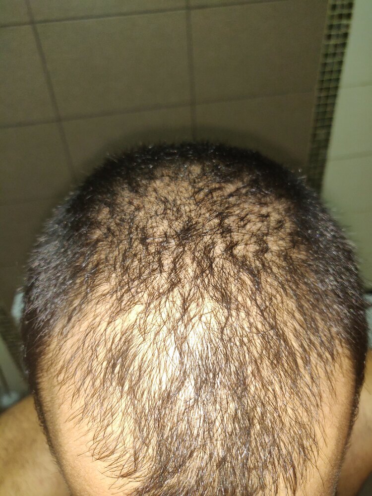 IMG 20201001 174914