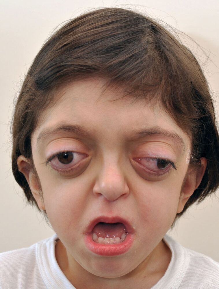 2CROUZON AFTER INITIAL OPERATIONS WEB