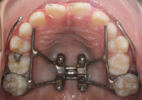 1 s20 S1073874618300094 gr11