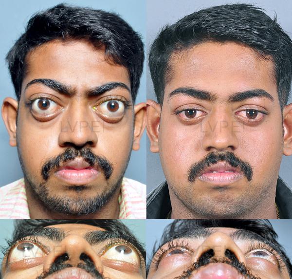 Decompression 1 WMopt600x573o00s600x573