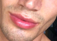 Lip