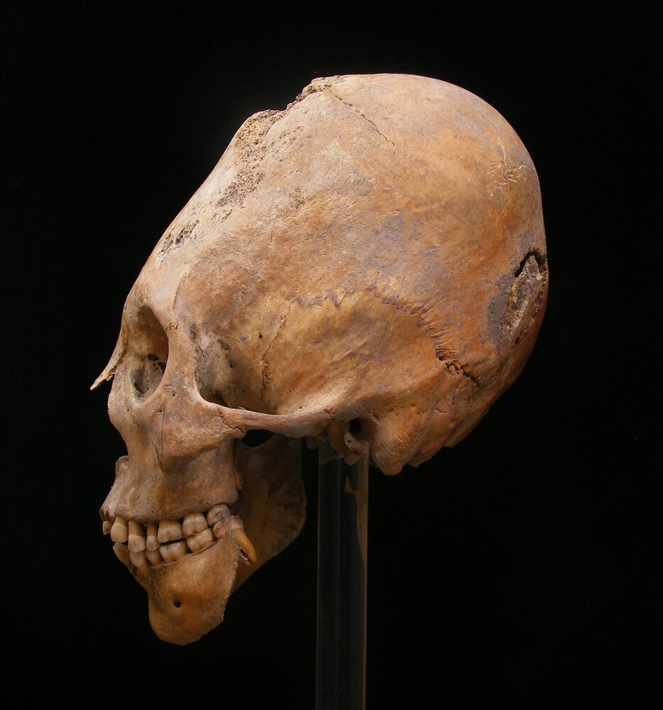 ConeSkull