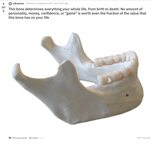 Mandibulardeterminism