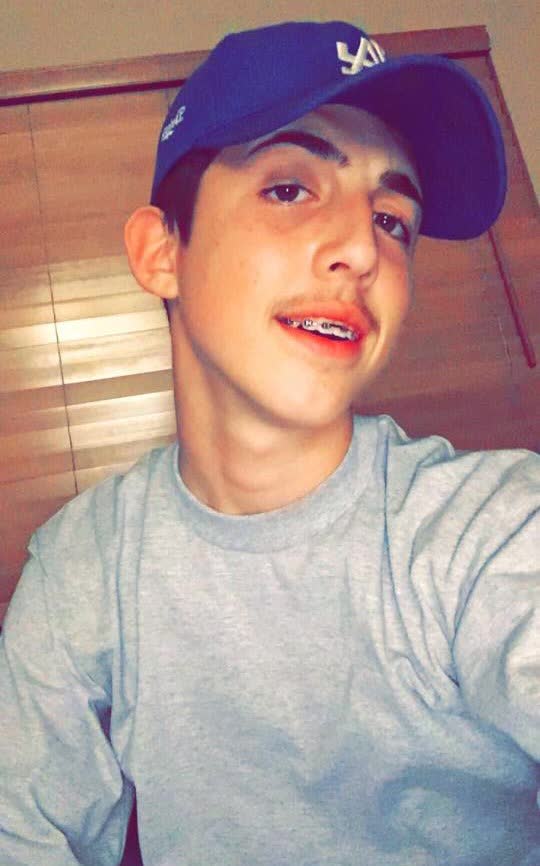 Nava1