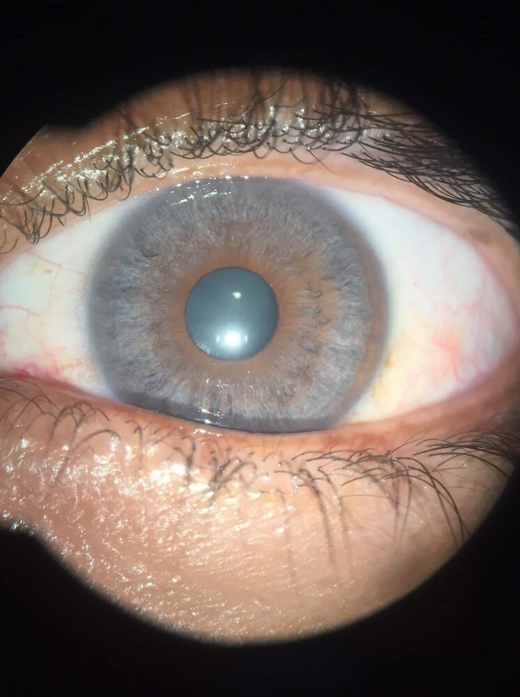 E5B87870 1850 4B22 9211 1077ABC6E6F0