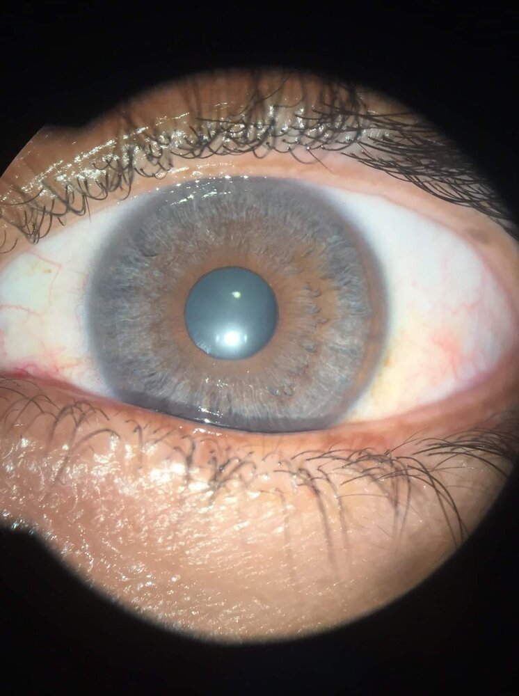 5AED2781 9A8E 4CA3 A8C8 402E922815D7