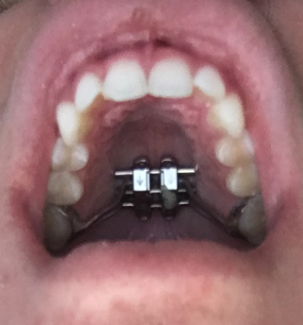 C4B4AC9D BA38 4CBC A832 6DBCFE783802