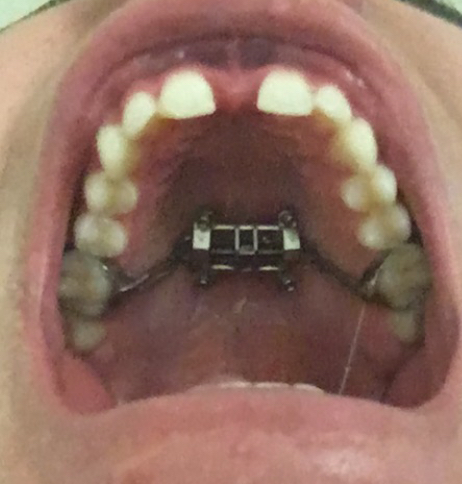 DCF43133 4356 4BDA AA07 03A747315013