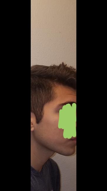 Jawline